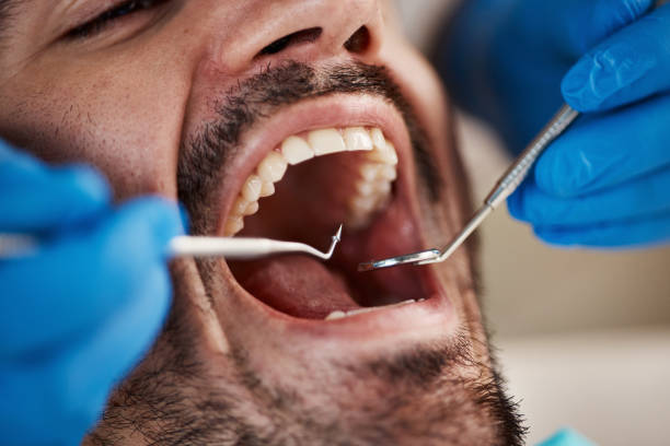Best Orthodontic Emergency Dentist in Tatum, TX