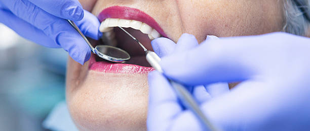 Best Emergency Dental Extractions in Tatum, TX